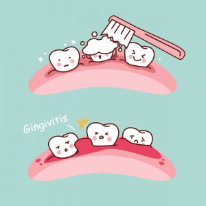 cartoon tooth brush and gingivitis, great for health dental care concept