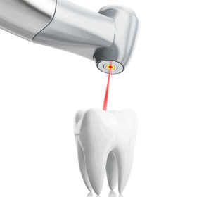 Dental Laser