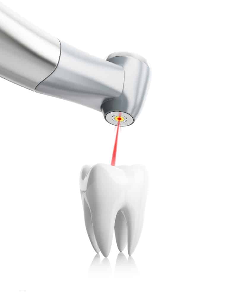 laser teeth whitening procedure, concept, isolated on white background