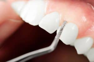 healthy gums that don't bleed when you floss