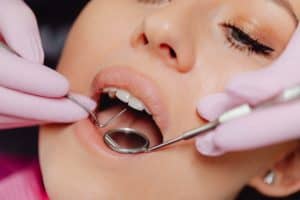 Dental Crowns and Veneers