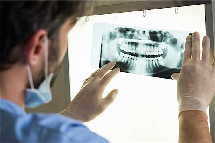 Dental x-ray Closeup of dentist looking at dental x-ray plate