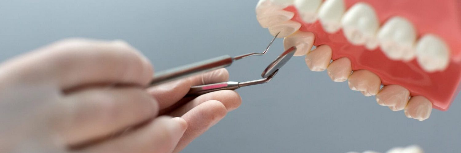 Dental Implants, idaho falls, local dentist near me, dental