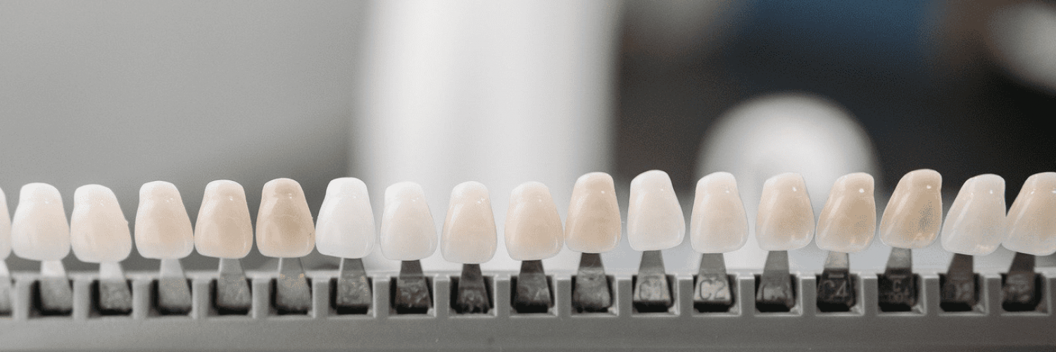 Dental Crowns and Veneers