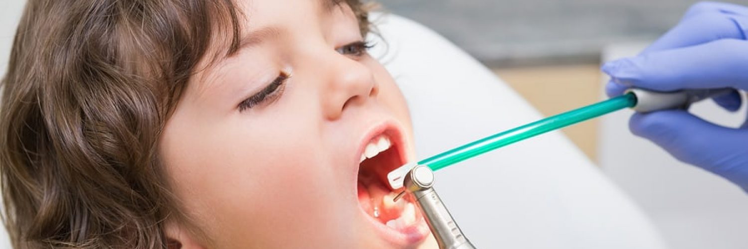 Kid's dentist examines boy's teeth for sealant needs