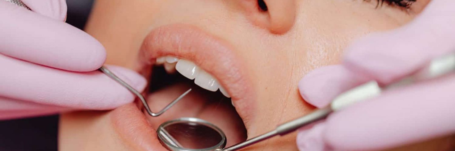 Dental Crowns and Veneers