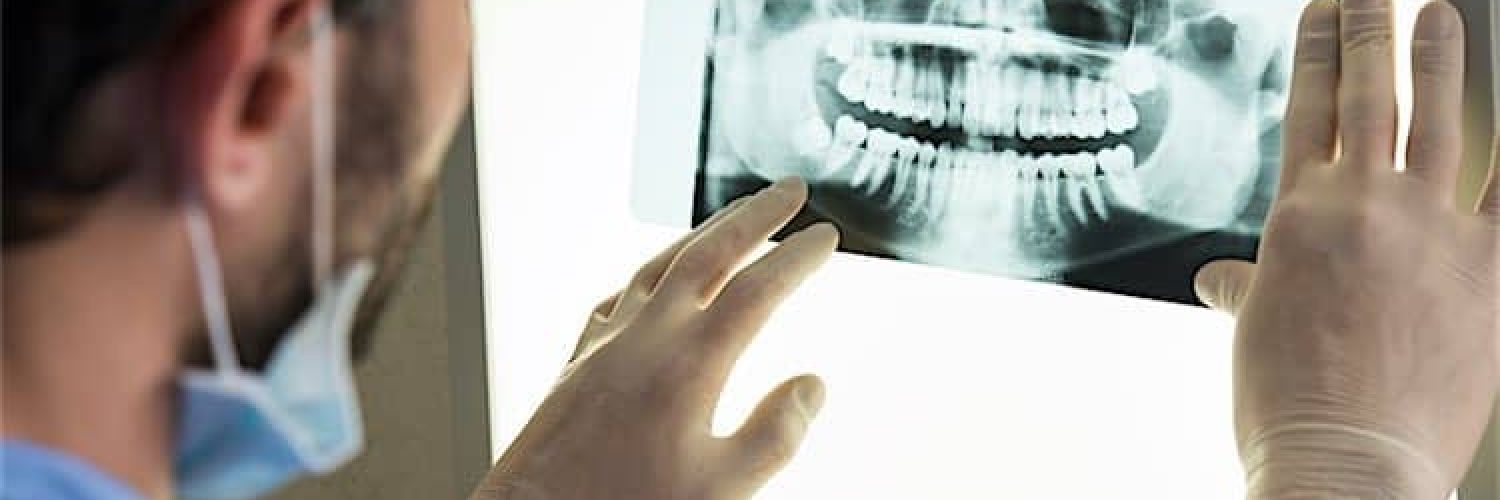 Closeup of dentist looking at dental x-ray plate