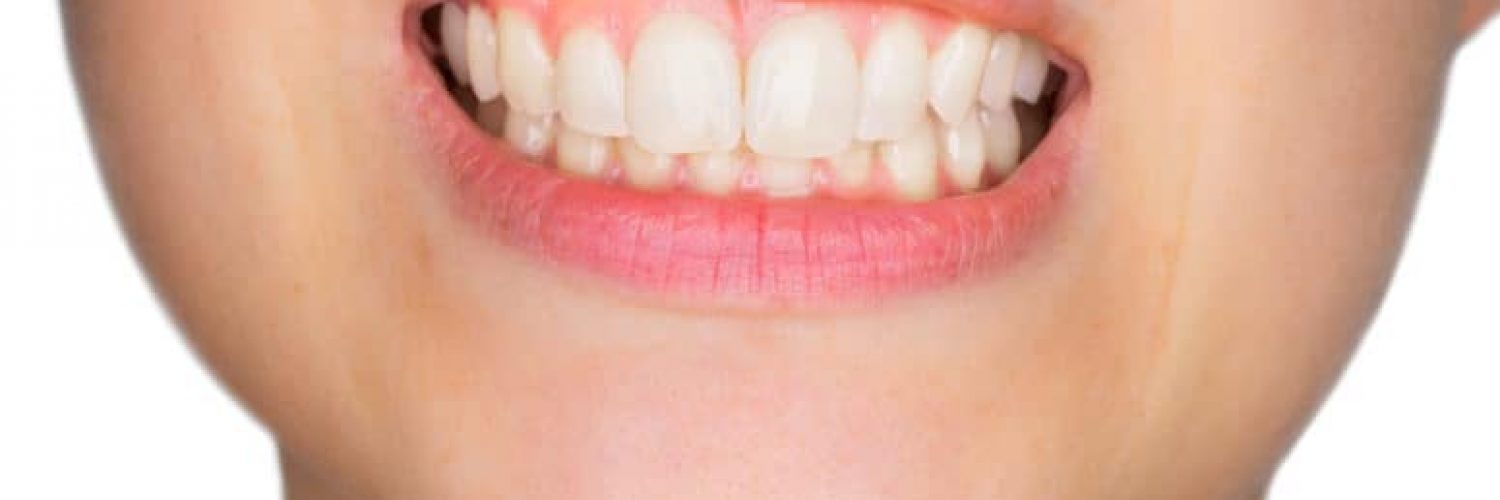 woman showing healthy gums