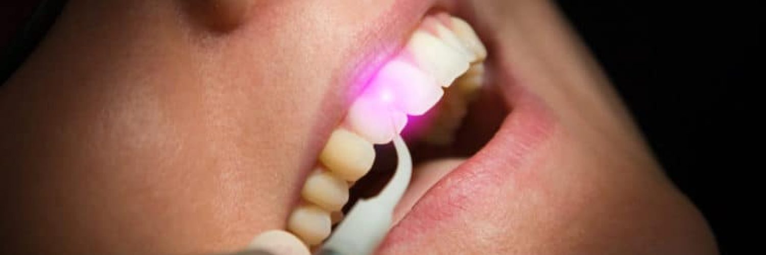 woman receiving dental laser cleaning