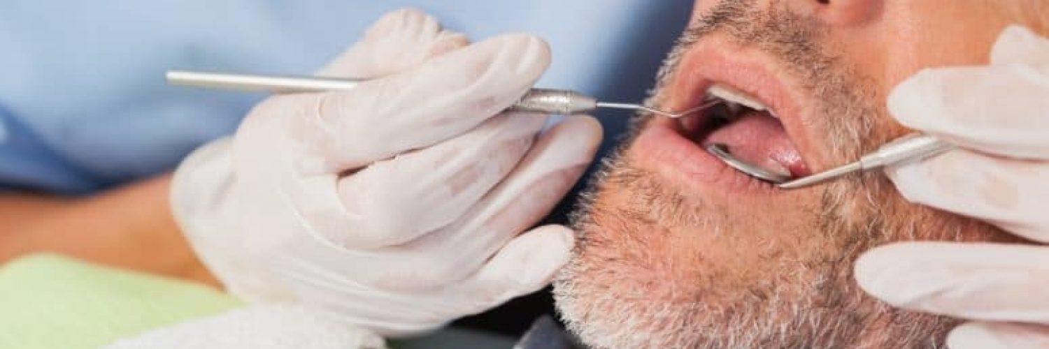 man under conscious sedation during dental cleaning