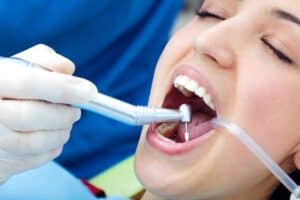 Patient Undergoing White Filling Treatment, idaho falls, local dentist near me, dental