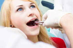 woman receiving tooth extraction from dentist